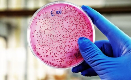 Aliments contaminés par la bactérie « E. coli » : quels effets sur la santé et comment prévenir les infections ?